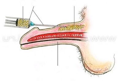 ТАЛСИЯИ ПЕШТАРИМА